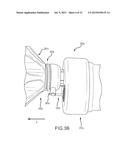 LEFT ATRIAL APPENDAGE TREATMENT SYSTEMS AND METHODS diagram and image