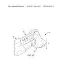 LEFT ATRIAL APPENDAGE TREATMENT SYSTEMS AND METHODS diagram and image