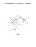 LEFT ATRIAL APPENDAGE TREATMENT SYSTEMS AND METHODS diagram and image