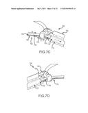 LEFT ATRIAL APPENDAGE TREATMENT SYSTEMS AND METHODS diagram and image