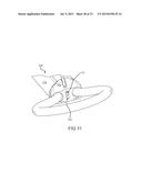 LEFT ATRIAL APPENDAGE TREATMENT SYSTEMS AND METHODS diagram and image