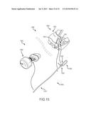 LEFT ATRIAL APPENDAGE TREATMENT SYSTEMS AND METHODS diagram and image