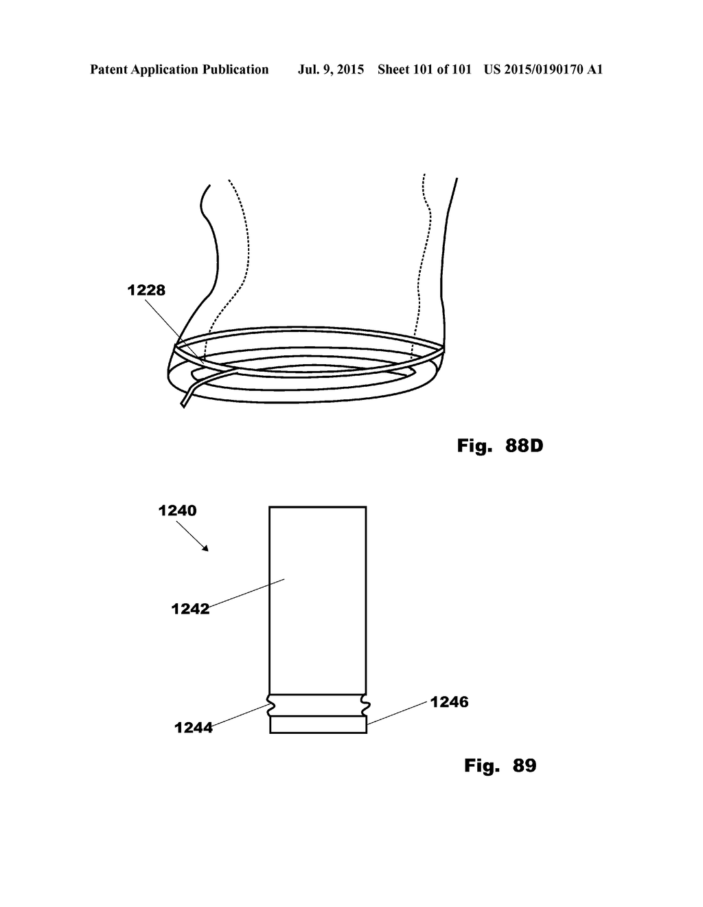 Methods, Systems and Devices for Surgical Access and Insertion - diagram, schematic, and image 102