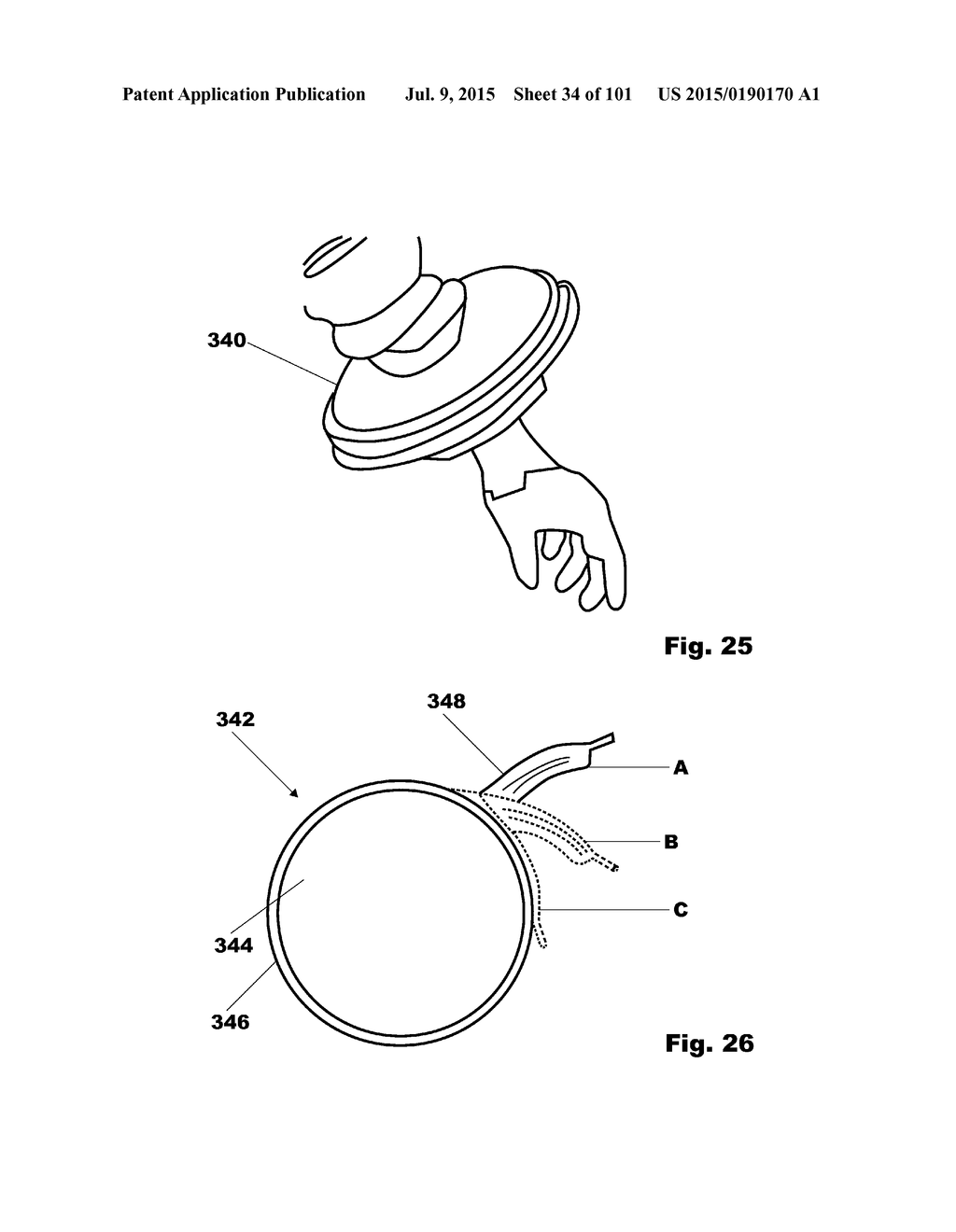 Methods, Systems and Devices for Surgical Access and Insertion - diagram, schematic, and image 35