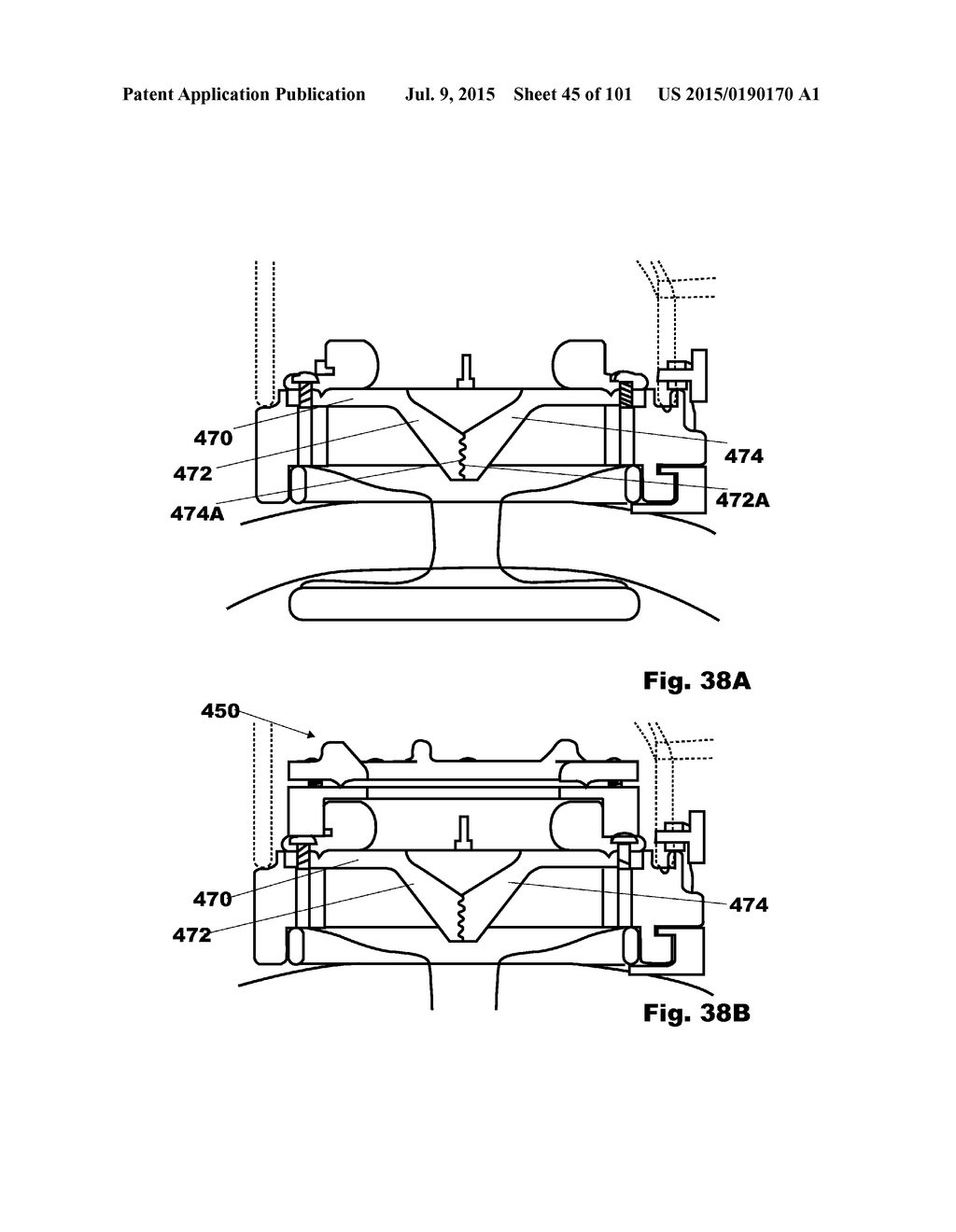 Methods, Systems and Devices for Surgical Access and Insertion - diagram, schematic, and image 46