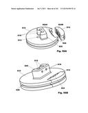 Methods, Systems and Devices for Surgical Access and Insertion diagram and image