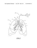 NON-INVASIVE AND MINIMALLY INVASIVE DENERVATION METHODS AND SYSTEMS FOR     PERFORMING THE SAME diagram and image