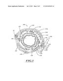 NON-INVASIVE AND MINIMALLY INVASIVE DENERVATION METHODS AND SYSTEMS FOR     PERFORMING THE SAME diagram and image