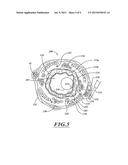 NON-INVASIVE AND MINIMALLY INVASIVE DENERVATION METHODS AND SYSTEMS FOR     PERFORMING THE SAME diagram and image