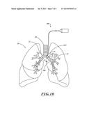 NON-INVASIVE AND MINIMALLY INVASIVE DENERVATION METHODS AND SYSTEMS FOR     PERFORMING THE SAME diagram and image