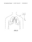 NON-INVASIVE AND MINIMALLY INVASIVE DENERVATION METHODS AND SYSTEMS FOR     PERFORMING THE SAME diagram and image