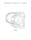 COMPONENTS FOR USE WITH A SURGICAL GUIDE FOR DENTAL IMPLANT PLACEMENT diagram and image