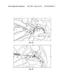 COMPONENTS FOR USE WITH A SURGICAL GUIDE FOR DENTAL IMPLANT PLACEMENT diagram and image