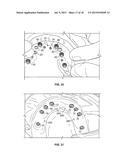 COMPONENTS FOR USE WITH A SURGICAL GUIDE FOR DENTAL IMPLANT PLACEMENT diagram and image