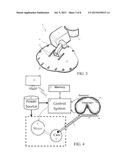 DIAPHRAGM ASSIST DEVICE diagram and image