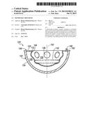 Deformable Prosthesis diagram and image