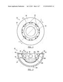 Deformable Prosthesis diagram and image