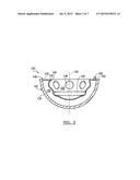 Deformable Prosthesis diagram and image