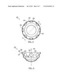 Deformable Prosthesis diagram and image