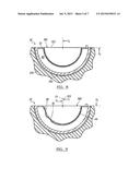 Deformable Prosthesis diagram and image