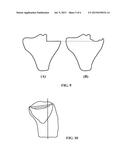 MIDLAY COMPARTMENTAL TIBIAL COMPONENT diagram and image