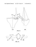 MIDLAY COMPARTMENTAL TIBIAL COMPONENT diagram and image