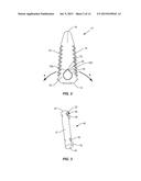 SPINAL IMPLANT SYSTEM AND METHOD diagram and image