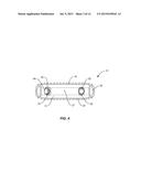 SPINAL IMPLANT SYSTEM AND METHOD diagram and image