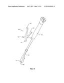 SPINAL IMPLANT SYSTEM AND METHOD diagram and image