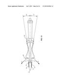 SPINAL IMPLANT SYSTEM AND METHOD diagram and image