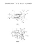 SPINAL IMPLANT SYSTEM AND METHOD diagram and image