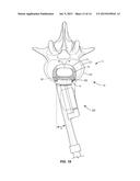 SPINAL IMPLANT SYSTEM AND METHOD diagram and image