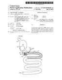 TRANSPYLORIC ANCHORING diagram and image