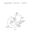 TRANSPYLORIC ANCHORING diagram and image