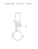 TRANSPYLORIC ANCHORING diagram and image