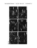 NEURONAL REGENERATION diagram and image