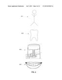 APPARATUS AND METHOD FOR PRODUCING A DENTAL BONE GRAFT diagram and image