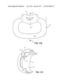 PATIENT INTERFACE SYSTEMS diagram and image