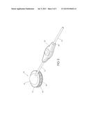 IMPLANTABLE SYSTEM FOR COLLECTION AND SUPPLY OF INTERSTITIAL FLUID diagram and image