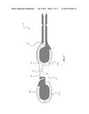 Moulded Stimulation Pad diagram and image