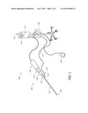 ULTRASOUND CATHETER SYSTEM diagram and image