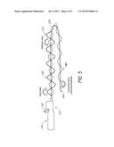 ULTRASOUND CATHETER SYSTEM diagram and image