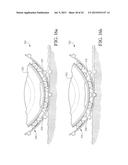 WHEEL AND TIRE ASSEMBLY WITH ADJUSTABLE SPACER SYSTEM diagram and image