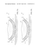 WHEEL AND TIRE ASSEMBLY WITH ADJUSTABLE SPACER SYSTEM diagram and image