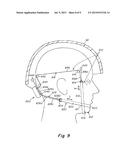 TENSIONING REEL diagram and image