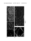 SYSTEMS AND METHODS TO DETECT BIOFILM STREAMER GROWTH AND THEIR USES diagram and image