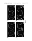 SYSTEMS AND METHODS TO DETECT BIOFILM STREAMER GROWTH AND THEIR USES diagram and image