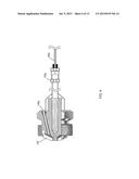 ISOLATOR SYSTEM diagram and image