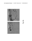 CORROSION RESISTANT ALUMINUM ALLOYS HAVING HIGH AMOUNTS OF MAGNESIUM AND     METHODS OF MAKING THE SAME diagram and image