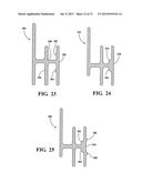 KIT AND ASSEMBLY FOR COMPENSATING FOR COEFFICIENTS OF THERMAL EXPANSION OF     DECORATIVE MOUNTED PANELS diagram and image